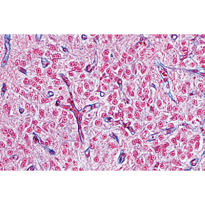 3B Endocrine System Micr. Slides/ Set of 5