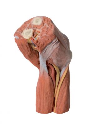 Cubital fossa - muscles, large nerves and the brachial artery
