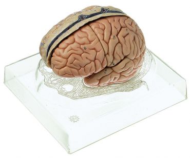SOMSO Model of Brain