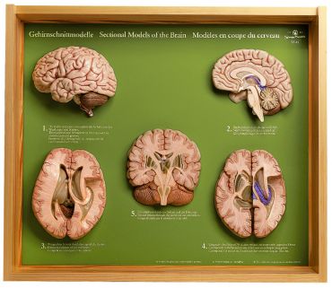 SOMSO 5 Section Models of the Brain