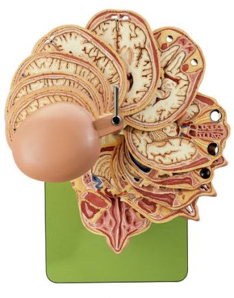 SOMSO Anatomical Sectional Model of the Head (combined with corresponding MR-Figures)