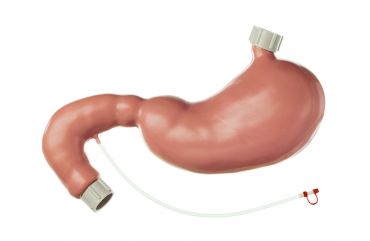 SOMSO CLA-Stomach and Duodenum