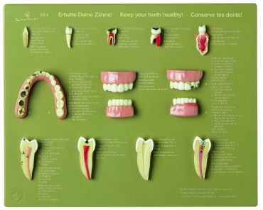 SOMSO Case of Teeth "Keep your Teeth healthy"