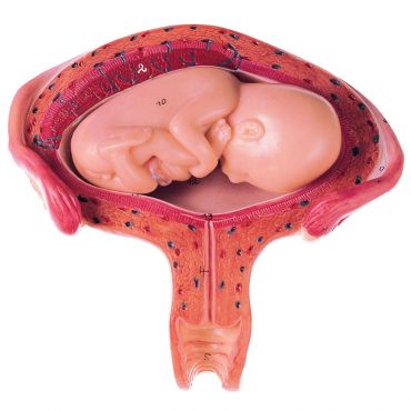 SOMSO Uterus with Fetus in Fourth to Fifth Month