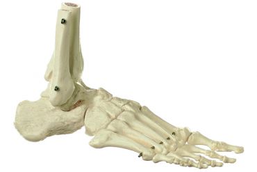 SOMSO Skeleton of the Foot (Rigid)