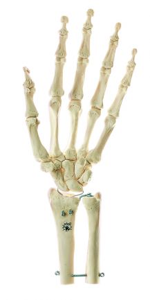SOMSO Skeleton of Hand with Base of Forearm