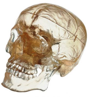 SOMSO Artificial Transparent Human Skull