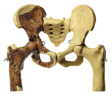 SOMSO Reconstruction of the Pelvis of Australopithecus africanus